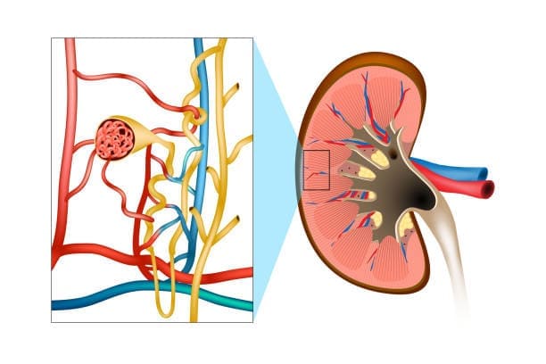 glomerulopatias