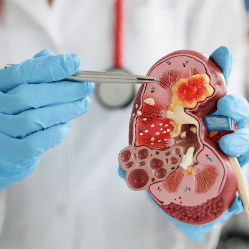 ¿Qué especialista trata la acidosis metabólica?